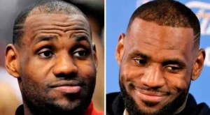 Trasplante capilar en famosos | LeBron James