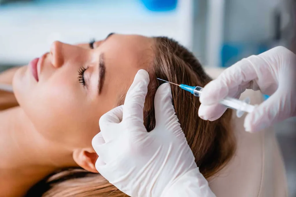 Tratamientos capilares para alopecia leve y como complemento al injerto capilar: mesoterapia capilar y PRP