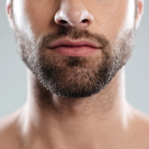 Injerto de barba