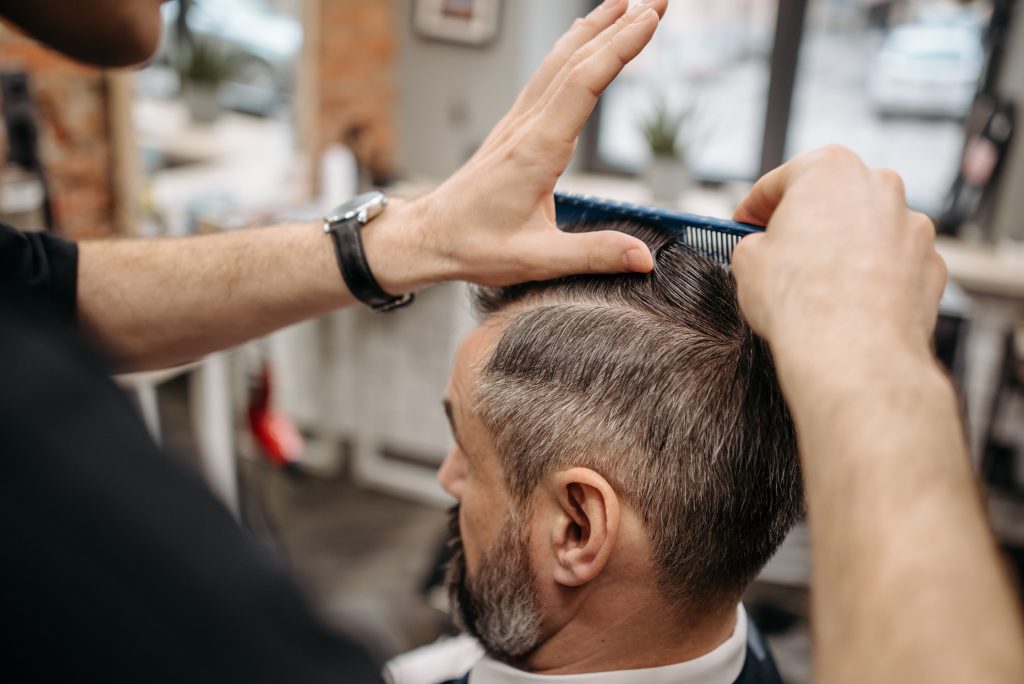 Primer plano de una línea frontal capilar tras un trasplante, mostrando un aspecto denso, natural y sin rastro de cicatrices lineales.